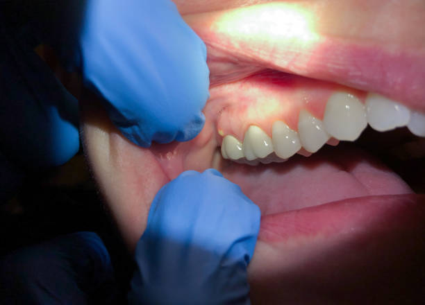 Best Same-Day Emergency Dentist in Lexington, KY