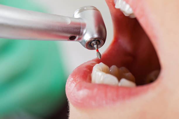 Best Emergency Treatment for Toothache in Lexington, KY